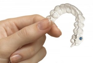 Invisalign15