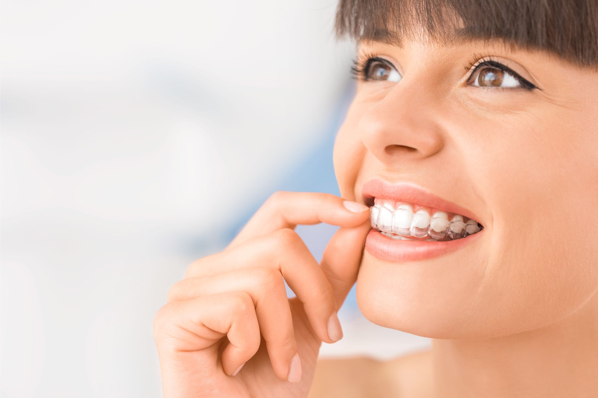 clear aligners allen tx