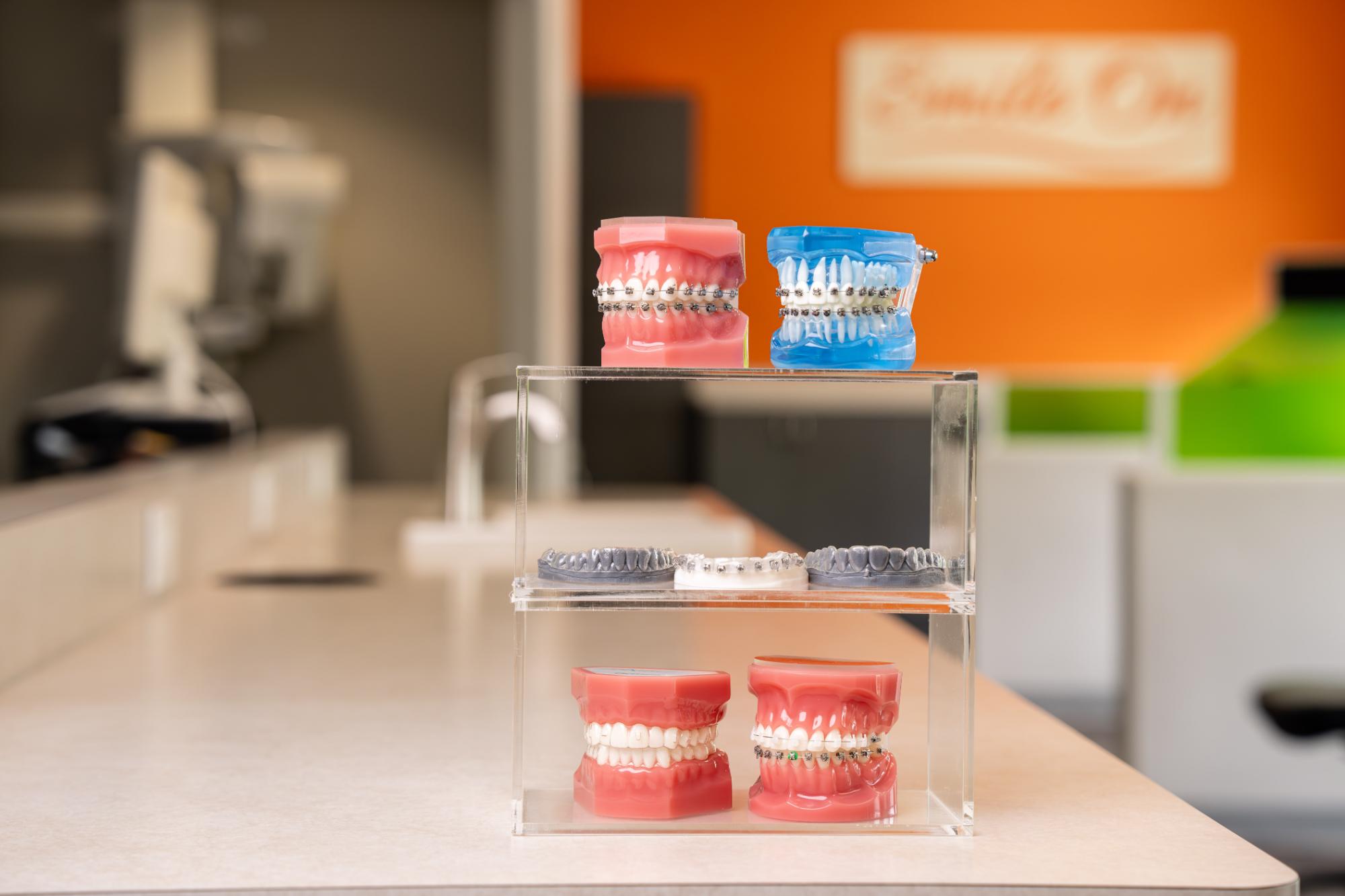 kraus-ortho-products--26 invisalign allen