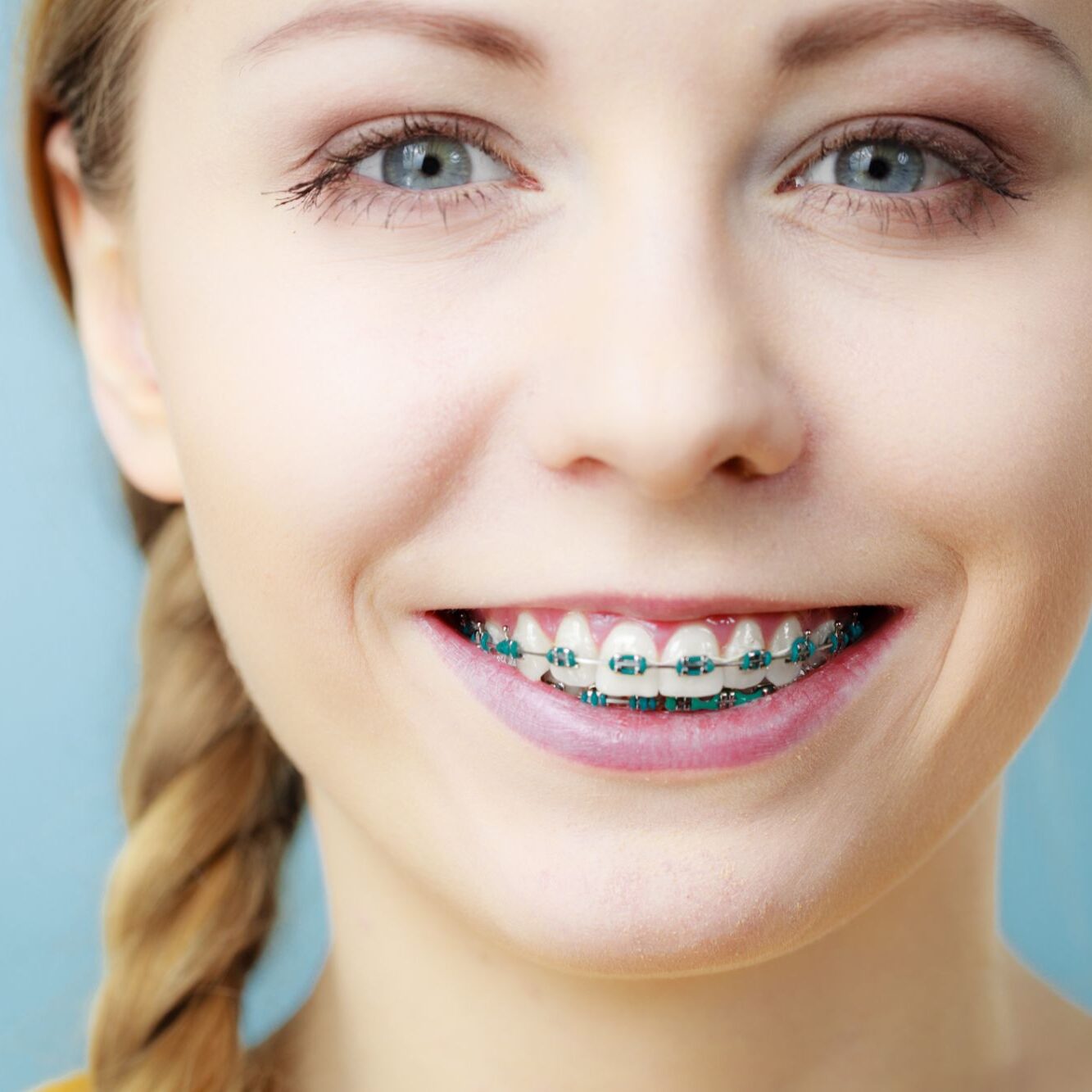 kraus orthodontics